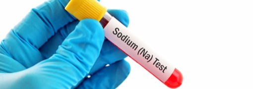 בדיקת רמת נתרן בדם (Sodium/Natrium) - תמונה